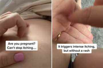 Soy partera y he aquí por qué las mujeres embarazadas NUNCA deben ignorar la picazón en la piel
