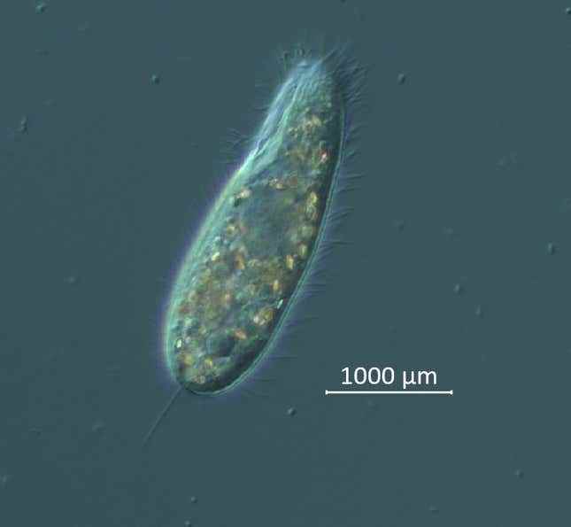 Mugshot: 2022'deki ölümün arkasında olduğuna inanılan mikroskobik siliat türleri.